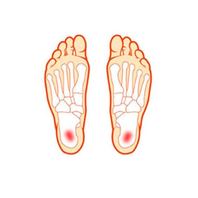 Фіксатор для пальця ноги Ultra Heel арт. 174, Pedag, (Німеччина) на сайті orto-med.com.ua